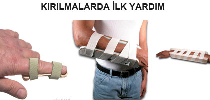 KIRIK, ÇIKIK, BURKULMALARDA İLK YARDIM